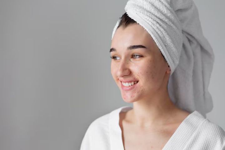 Discover Acne Scar Solutions: Advanced Techniques Explained